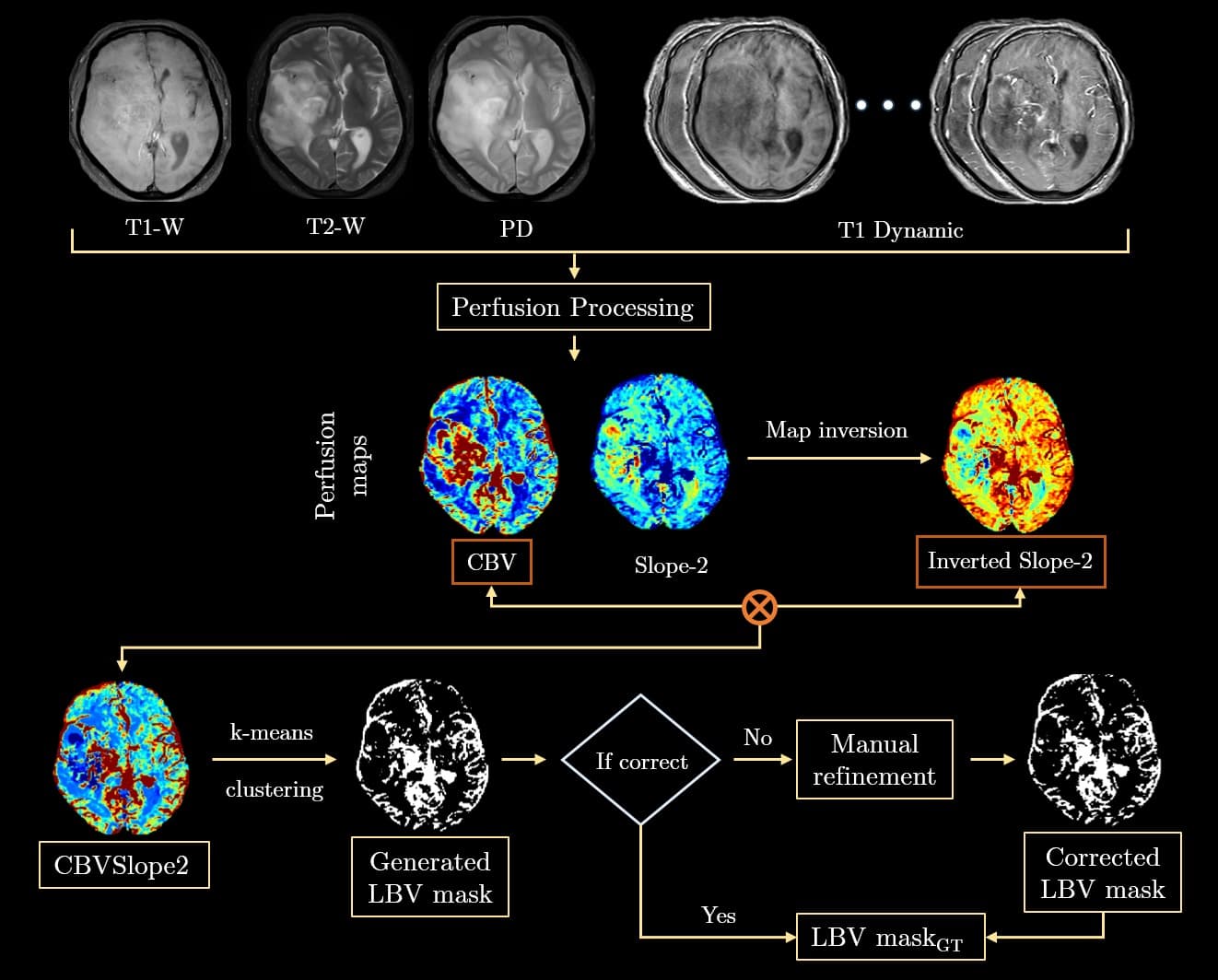 Pipeline: T1/T2/PD and dynamic MRI through perfusion processing to CBV and Slope-2 maps, k-means clustering of CBVSlope2, and LBV mask generation with manual refinement.